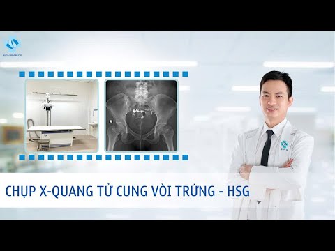 Chụp X-quang tử cung vòi trứng (HSG)